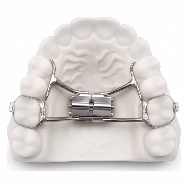 Rapid palatal expander (Hyrax) with banded first molars and midline expansion screw on an upper model, lab-made for orthodontists
