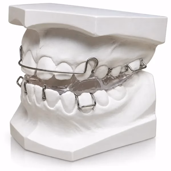 Twin block functional appliance with clear acrylic upper and lower blocks on white study models, lab-made for orthodontists
